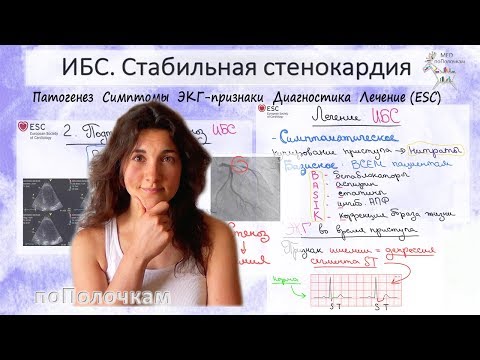 Видео: Самое важное по теме ИБС и стабильная стенокардия
