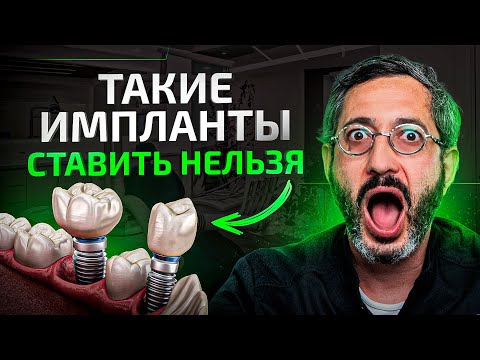 Видео: Никогда не ставь такие импланты. Что нужно знать об имплантации зубов?