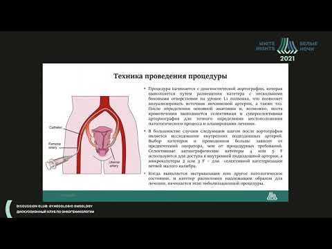 Видео: Отдаленные результаты лечения местнораспространенного рака шейки матки, осложненного кровотечением