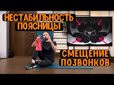 Видео: Нестабильность поясницы - Упражнения | Спондилолистез | Функциональная нестабильность | Смещение