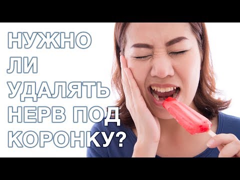 Видео: Удалять ли нерв под коронку?