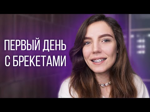 Видео: ПОСТАВИЛА БРЕКЕТЫ! ОЩУЩЕНИЯ \ ВПЕЧАТЛЕНИЯ