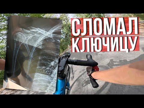 Видео: Как я сломал ключицу на велосипеде