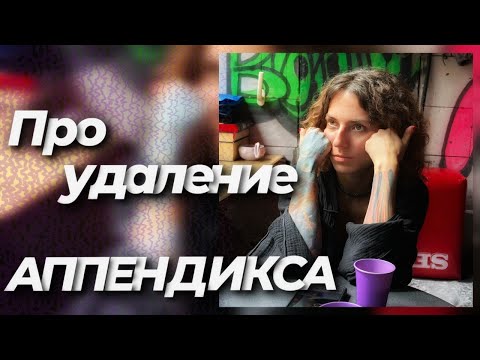 Видео: ПРО УДАЛЕНИЕ АППЕНДИКСА