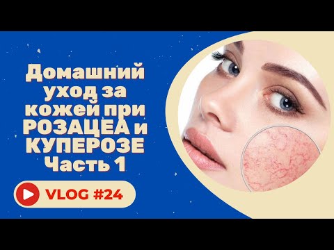 Видео: #24 Домашний уход за кожей при розацеа и куперозе. Советы косметолога. Часть 1.
