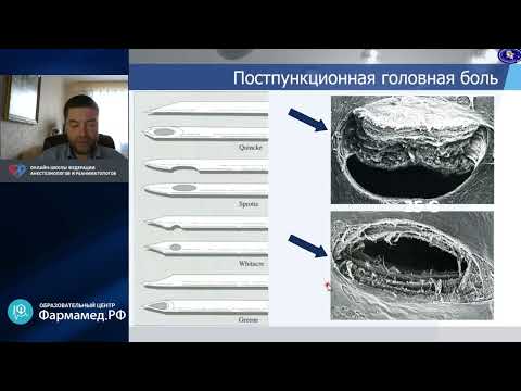 Видео: Нейроаксиальная анестезия Любошевский П.А.