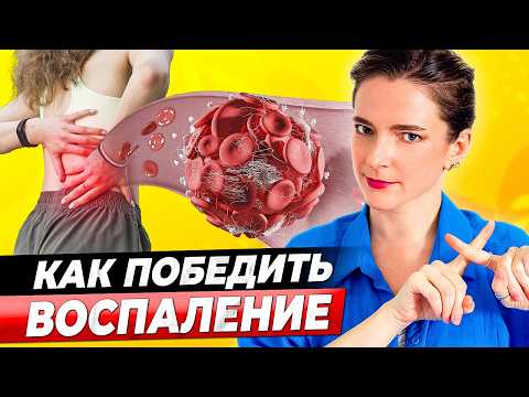 Видео: 3 шага снизить ЛЮБОЕ воспаление – как уменьшить боль и воспаление БЕЗ ЛЕКАРСТВ