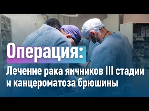 Видео: Клиника "Медицина": Лечение рака яичников с канцероматозом брюшины