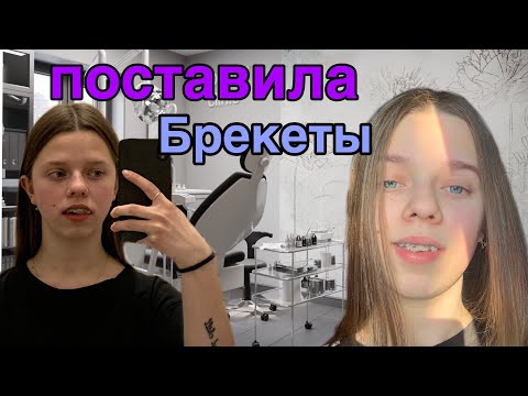 Видео: Мне поставили брекеты / больно!?