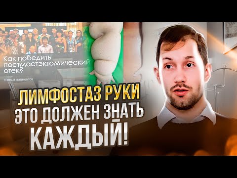 Видео: ЛИМФОСТАЗ РУКИ - это должен знать каждый!