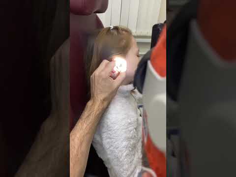 Видео: Что достали из уха ребёнка?