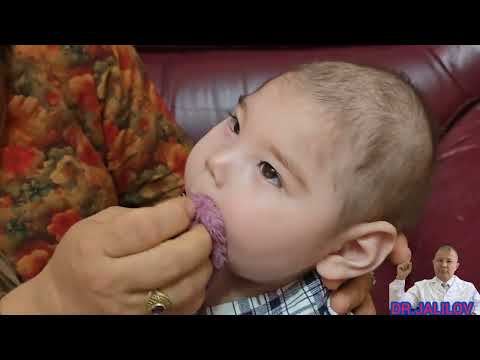 Видео: МИКРОЦЕФАЛИЯ