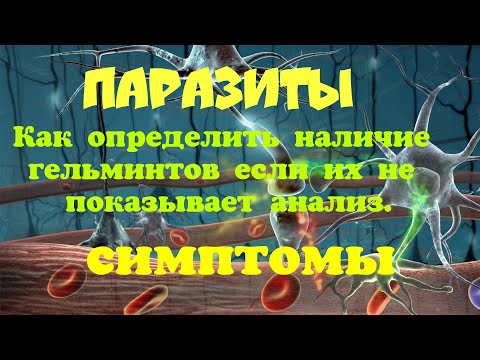 Видео: Лямблиоз, описторхоз. Как определить наличие гельминтов если их не показывает анализ.Симптомы.