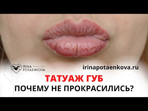 Видео: Почему татуаж губ не взялся?