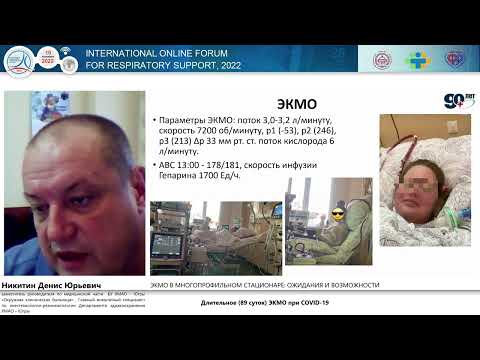 Видео: Дительное ЭКМО Никитин Д.Ю.