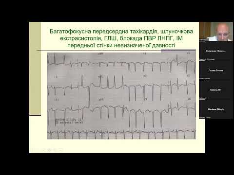 Видео: Суправентрикулярні тахікардії (частина 2)