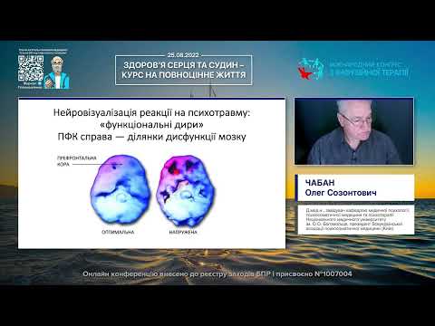 Видео: Еустрес, дистрес, постстрес. Розбираємося і лікуємо (Чабан Олег Созонтович)