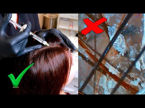 Видео: ВЫПАДАЮТ ВОЛОСЫ ЧТО ДЕЛАТЬ? Полная консультация трихолога трихоскопия