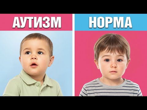 Видео: РОДИТЕЛИ, не упустите! 10 Едва заметных признаков аутизма