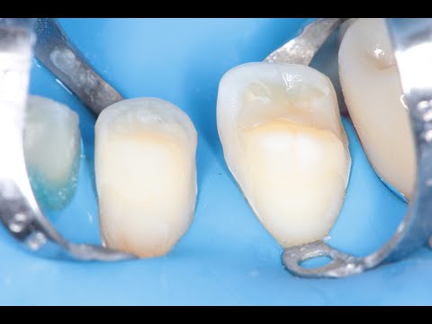 Видео: СТОМБУДНИ#56 попал на 140 000