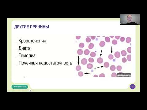 Видео: Академия RUSSCO для подготовки к экзамену ESMO:«Анемия. Тромбоцитопения» (вебинар 31 августа 2025)