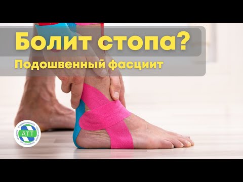Видео: Боль в стопе. Подошвенный фасциит. Тейпирование стопы
