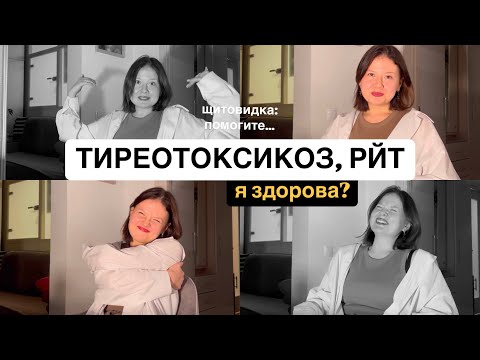 Видео: РАДИОЙОДтерапия ГОД спустя!