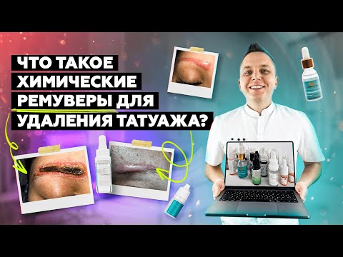 Видео: Что такое ХИМИЧЕСКИЕ РЕМУВЕРЫ для удаления татуажа?