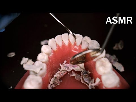 Видео: Ролевая игра в стоматолога с неразборчивыми инструментами💉ASMR [Субтитры, Пирсинг]