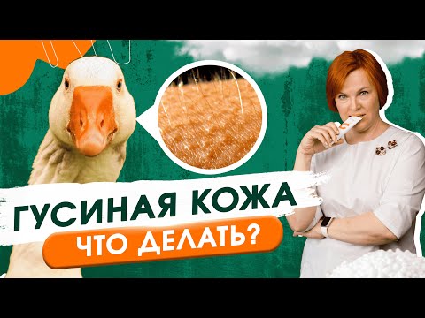 Видео: Гусиная кожа на руках и ногах. Что делать?