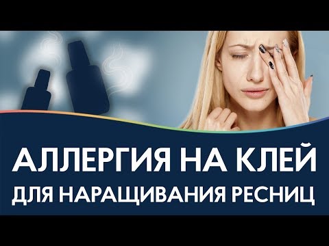 Видео: АЛЛЕРГИЯ НА КЛЕЙ У МАСТЕРА 😪 ТОП 10 средств от аллергии