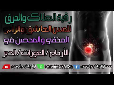 Видео: Рукия против колдовства на импотенцию, бесплодие, зина. Абу-Яхъя