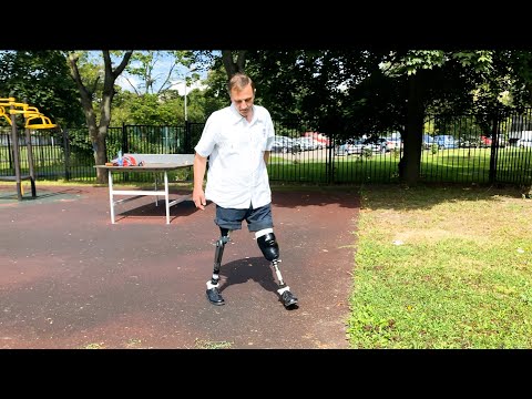 Видео: ЧАСТЬ 4 : На ПРОТЕЗАХ НОГ учусь ХОДИТЬ без костылей. "Микропроцессорные коленные модули"