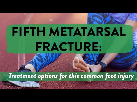 Видео: Перелом пятой плюсневой кости: варианты лечения этой распространенной травмы стопы
