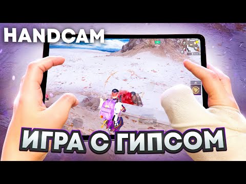 Видео: КАК Я ИГРАЮ С ГИПСОМ НА ПАЛЬЦЕ? 🔥 | METRO ROYALE | PUBG MOBILE