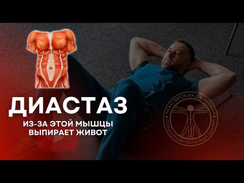 Видео: ДИАСТАЗ ИЗ-ЗА ЭТОЙ МЫШЦЫ ВЫПИРАЕТ ЖИВОТ