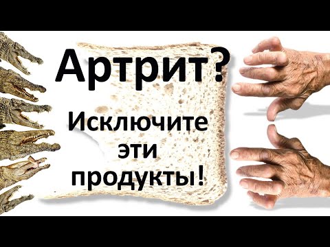 Видео: Как питаться при артрите чтобы уменьшить воспаление?
