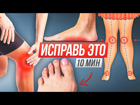 Видео: ПРОБЛЕМЫ СО СТОПАМИ И ОСАНКОЙ! ЛУЧШИЕ УПРАЖНЕНИЯ!