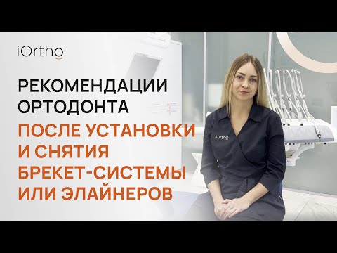 Видео: 👩‍⚕️​ Рекомендации ортодонта после установки и снятия брекет-системы или элайнеров