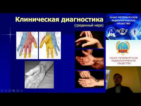 Видео: Малецкий Э.Ю. Ультразвуковая диагностика травматических поражений нервов