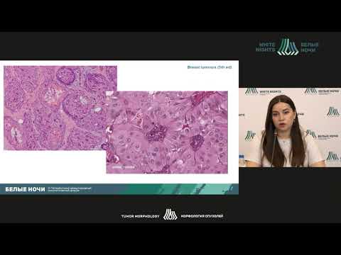 Видео: Опухоли молочной железы ВОЗ 2020: обзор (Чуглова Д.А.)