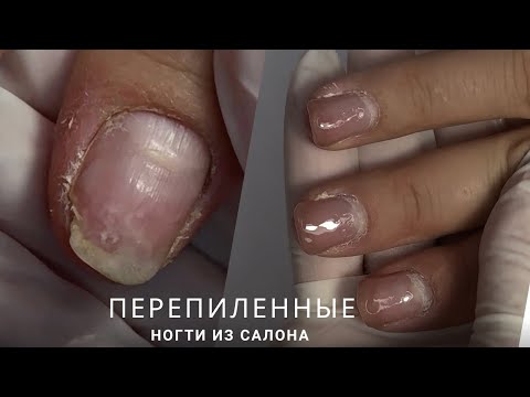 Видео: Поврежденные ногти КАК БЫТЬ? чтоб носилось/наращивание без форм