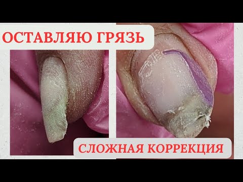 Видео: КАК МОЖНО ПОКРЫВАТЬ ЭТУ ГРЯЗЬ 😱 // СЛОЖНАЯ КОРРЕКЦИЯ // КРИВЫЕ НОГТИ // МАНИКЮР