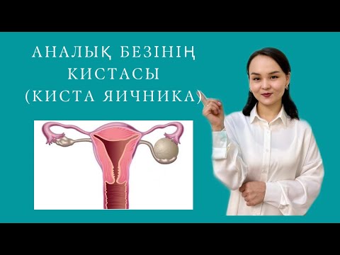 Видео: Аналық безінің кистасы#Аналык безинин кистасы#Фолликулярлық киста#Киста яичника лечение#