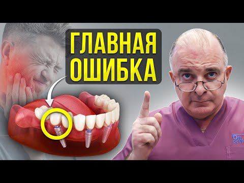 Видео: Не ставь ALL ON 4, пока не узнаешь ЭТО! Вся правда об имплантации зубов
