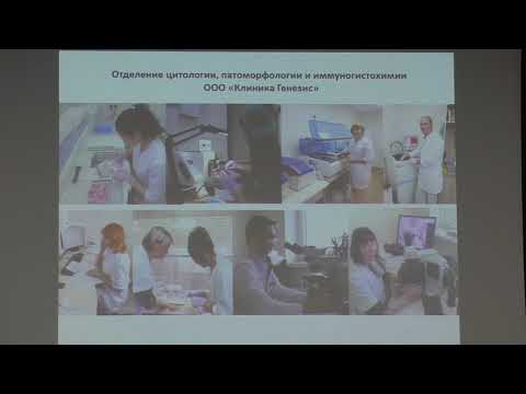 Видео: 03 Филоненко ТГ Федотов ВВ Атрофия Метаплазия Дисплазия желудка Взгляд патоморфолога