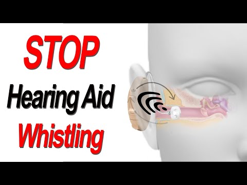 Видео: 8 шагов, чтобы перестать свистеть в слуховом аппарате из-за обратной связи