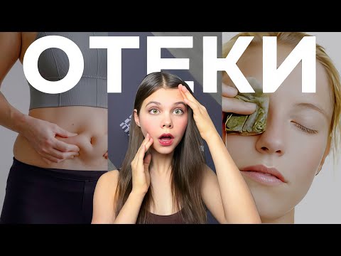 Видео: Я перестала отекать — вот мои секреты | КАК ИЗБАВИТЬСЯ ОТ ОТЕКОВ?