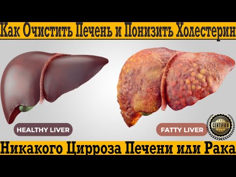 Видео: Как очистить печень и понизить холестерин быстро!