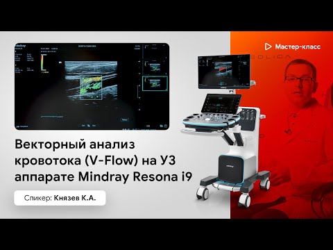 Видео: Векторный анализ кровотока (V-Flow) на Mindray Resona i9